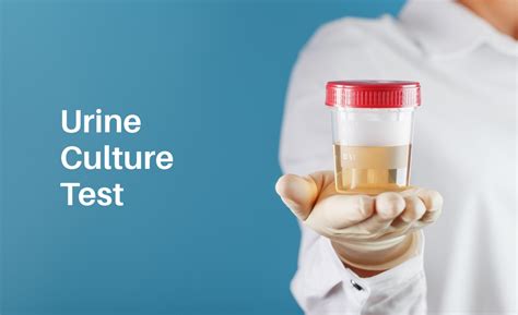 urine cs test meaning|Urine Culture Test: Purpose, Duration, Levels of Bacteria in Urine .